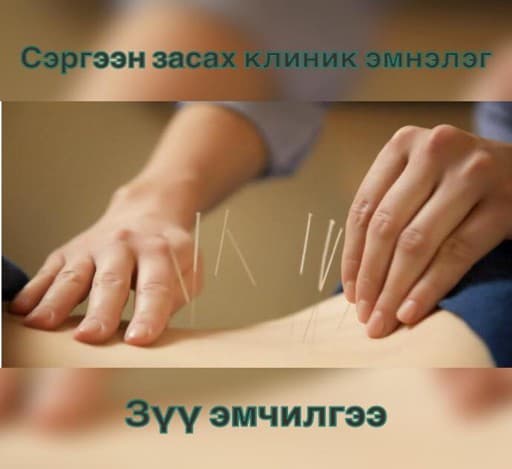 Зүү эмчилгээ